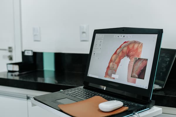 intraoral scanner for oral rehabilitation